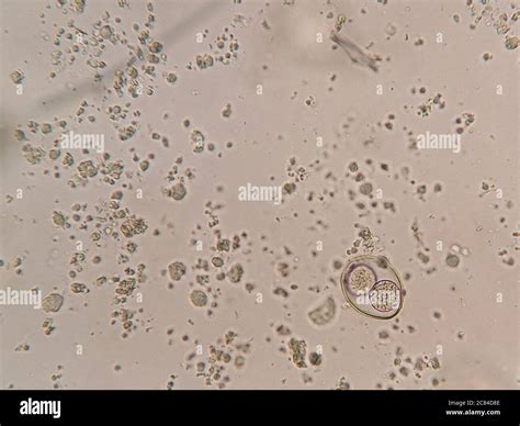  Isospora! Een microscopische roofridder die je darmen koloniseert